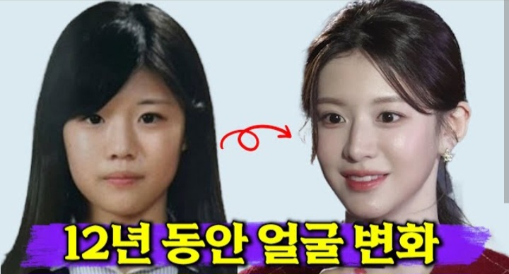 고윤정 과거 전후 사진비교(0)
