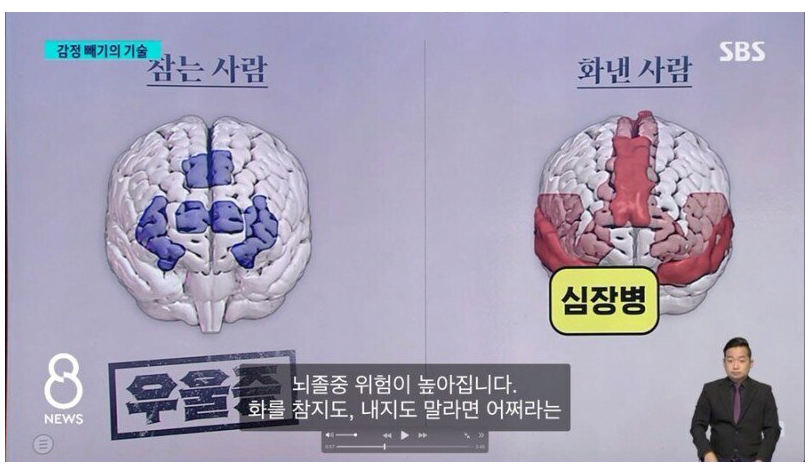 화 참는 사람 vs 화낸 사람 뇌 비교(0)