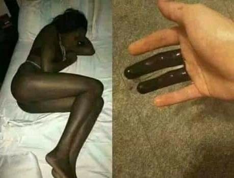 다리가 아픈거면 통풍인가요(0)