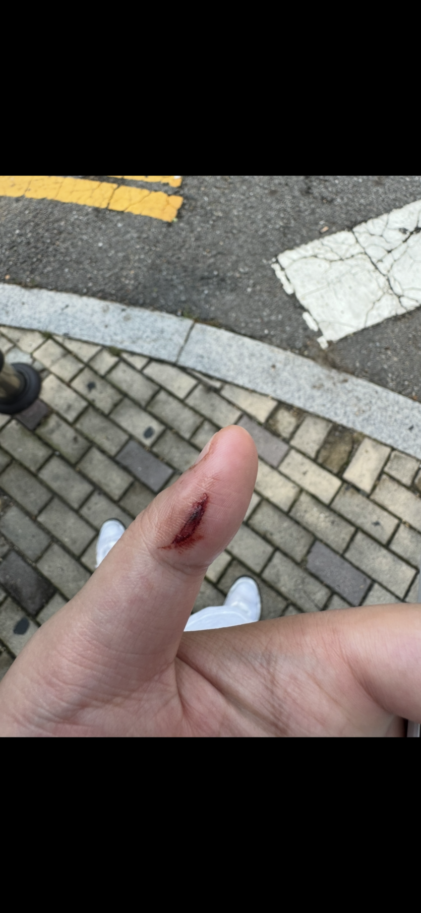 면도는조심히(0)
