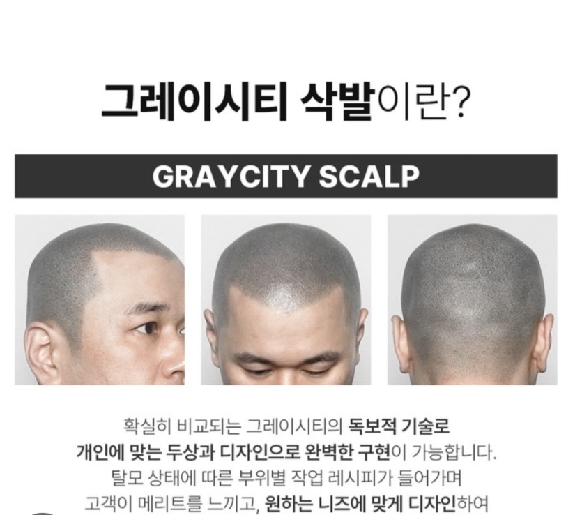 대머리들의 마지막희망(0)