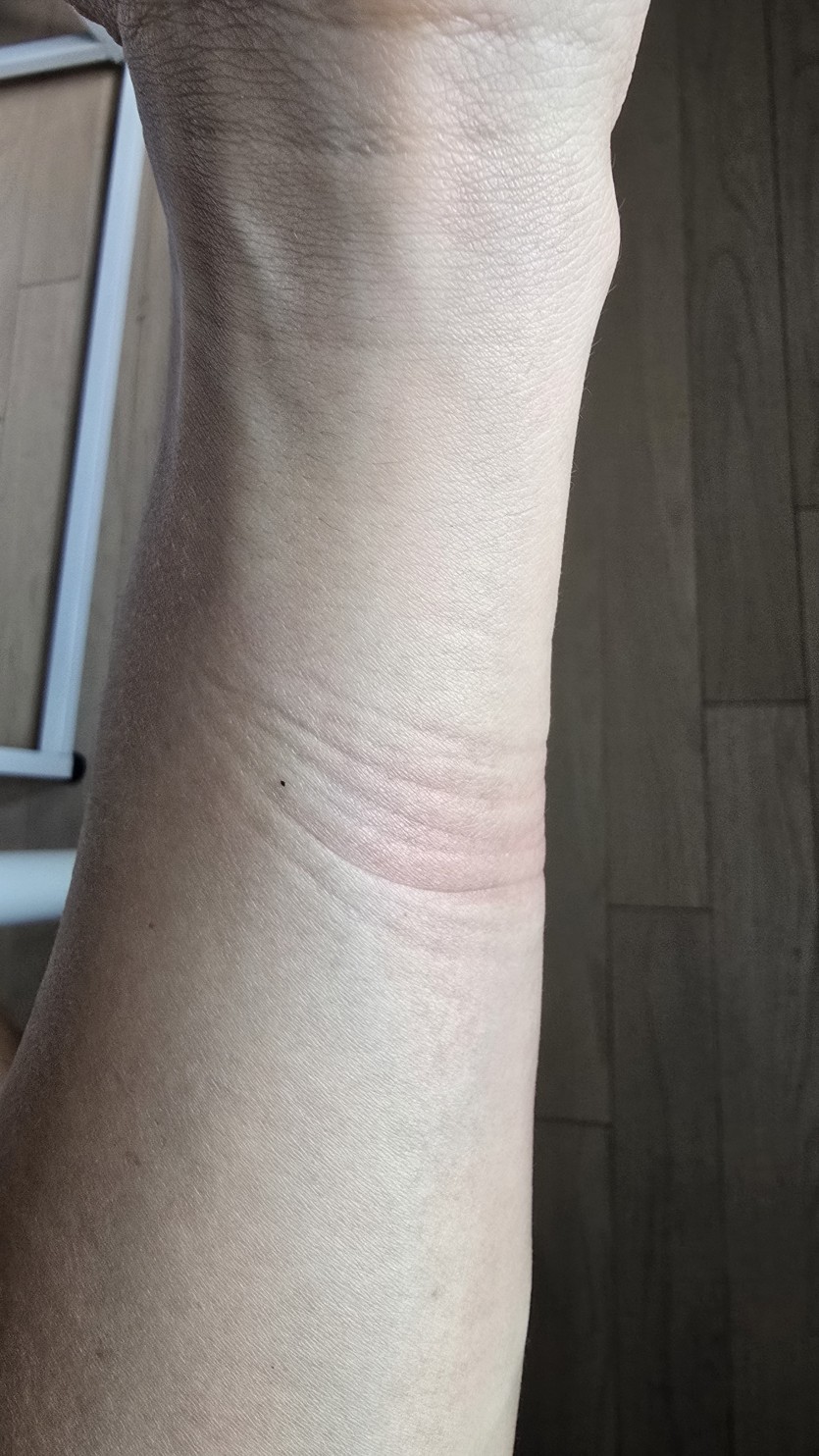 저에게는 전쟁흔이있습니다..(0)