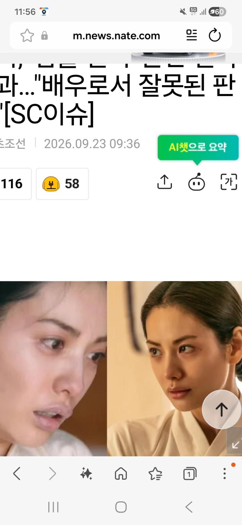 나나  입술필러 과도하게 맞아서..(0)
