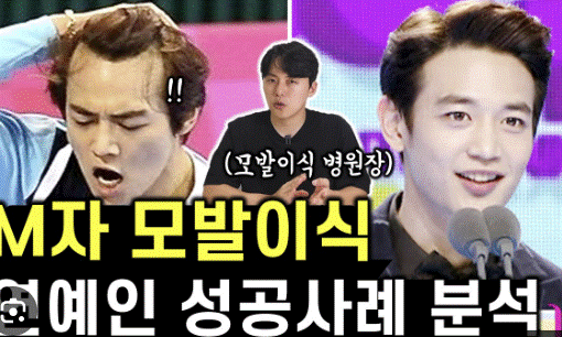 민호도 탈모엿구나..(0)