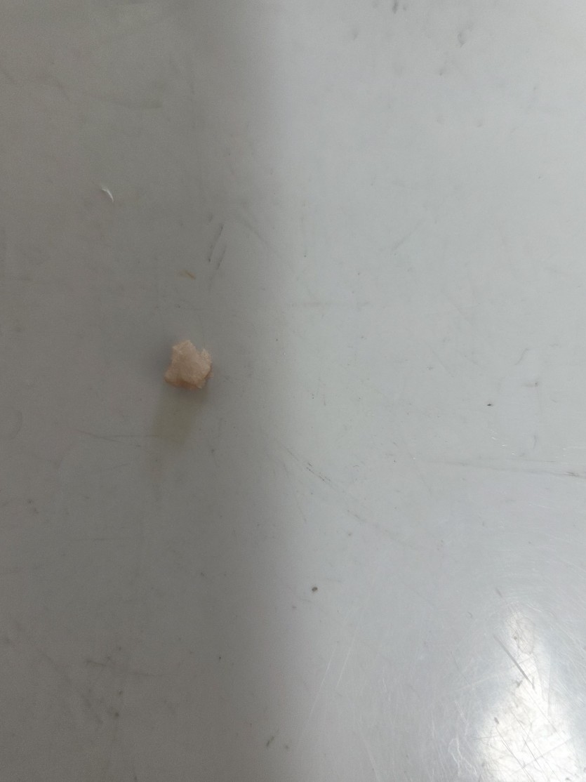 오늘 동그랑땡 먹다가 돌나온거(0)