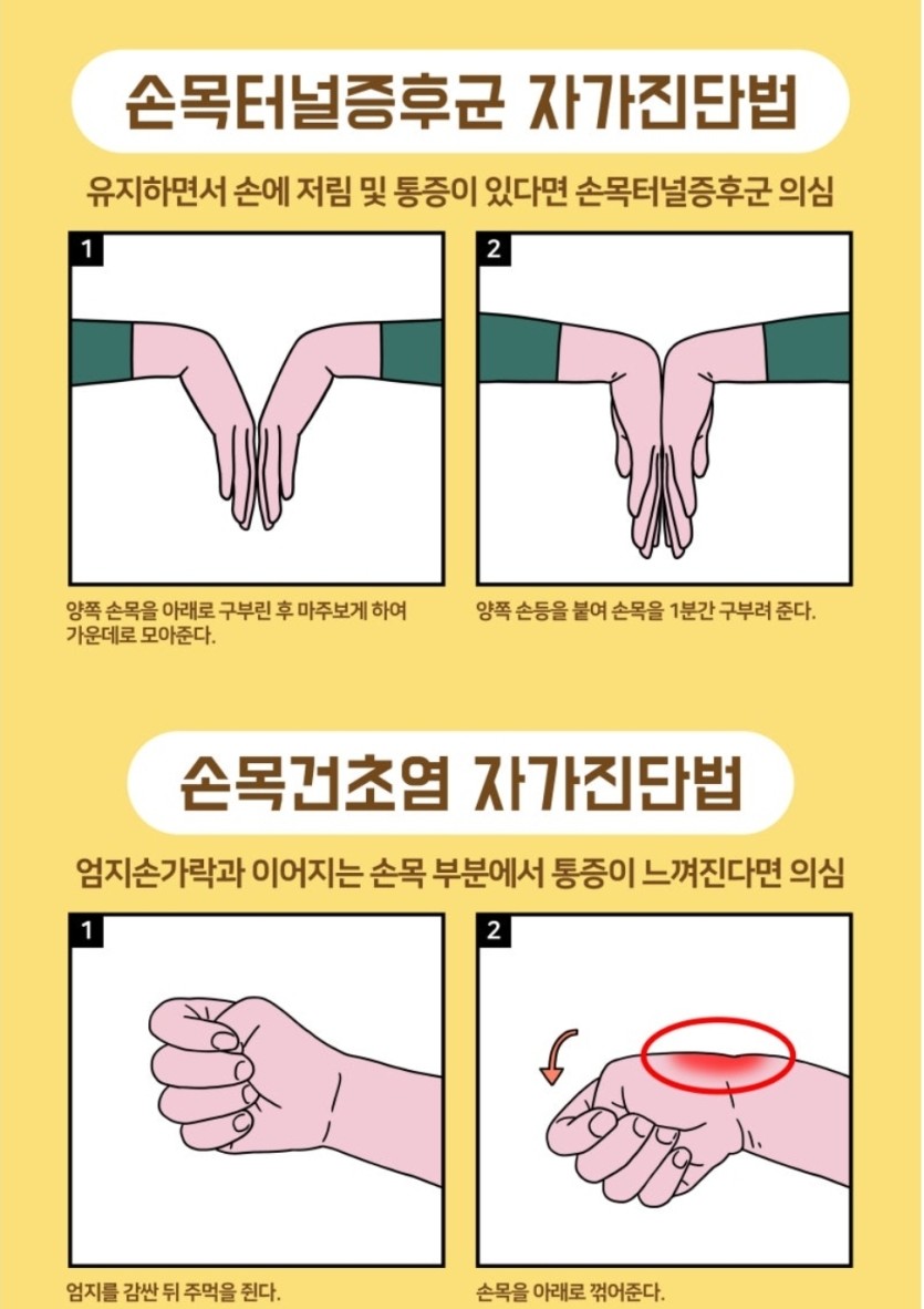 건초염과 손목 터널증후군(0)