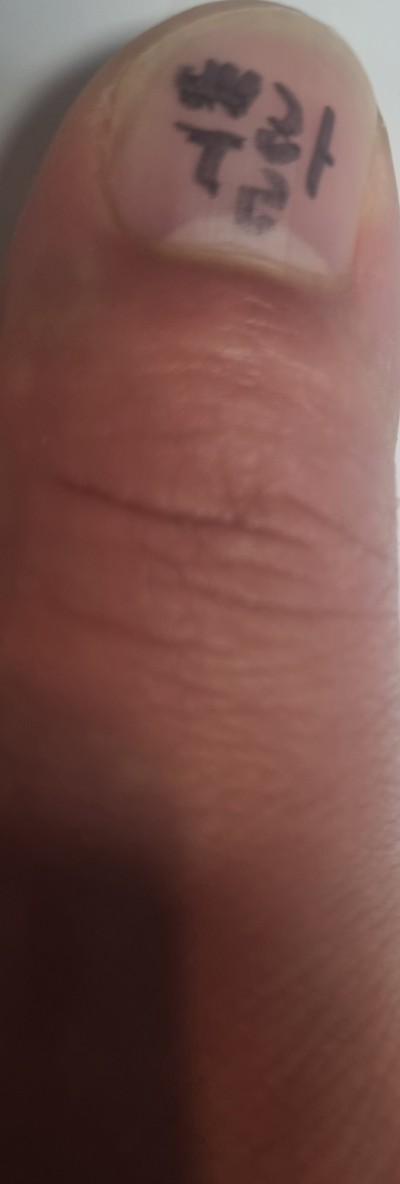 (0)